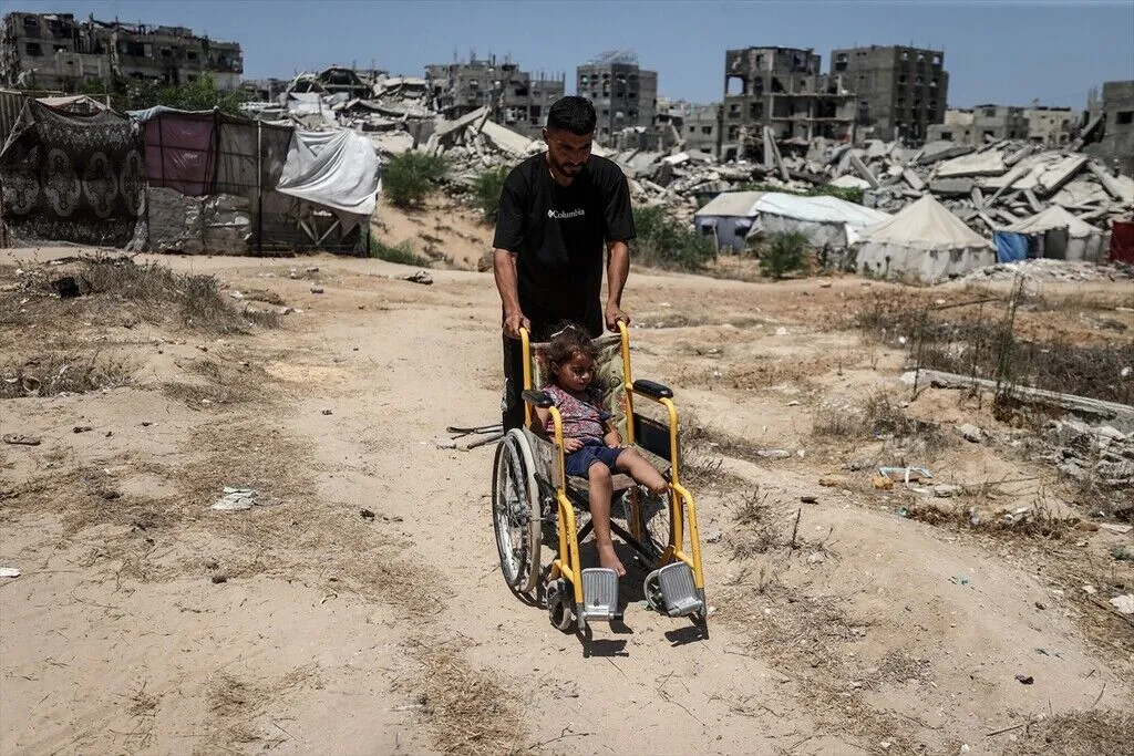 İsrail Saldırısında Bir Bacağını Kaybeden Gazzeli Cemalat, Hayata Tutunmaya Çalışıyor12