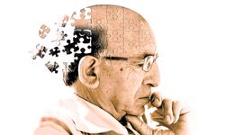 Alzheimer'ın ilerlemesini yavaşlatan ilaca onay