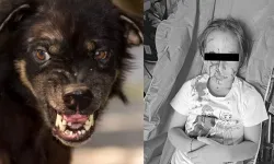 Başıboş köpek sorunu hayatları mahvediyor: 6 yaşındaki kızın suratı parçalandı