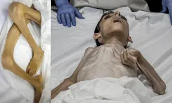 Bu utanç daha ne kadar sürecek? Gazze'de bir çocuk daha açlıktan öldü