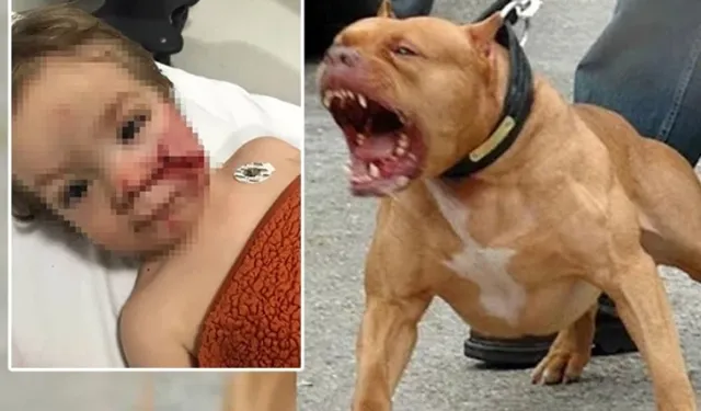 Ankara'da pitbull dehşeti! Daha kaç çocuğun parçalanması gerekiyor?