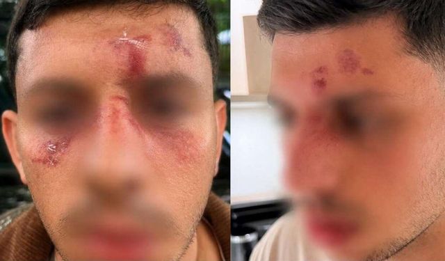 Hiçbir yerde rahat edemeyecekler: Londra'da Yahudiye meydan dayağı