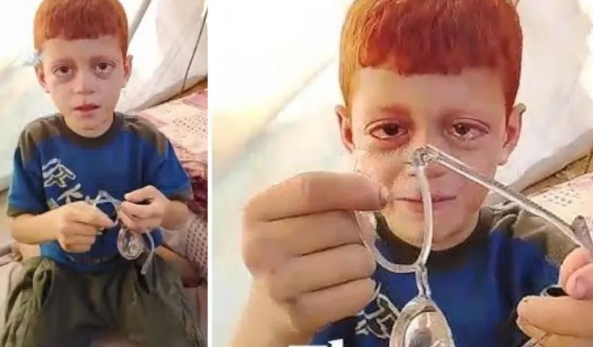 Gazze’de gözlüğü kırılan çocuğun yardım çığlığı
